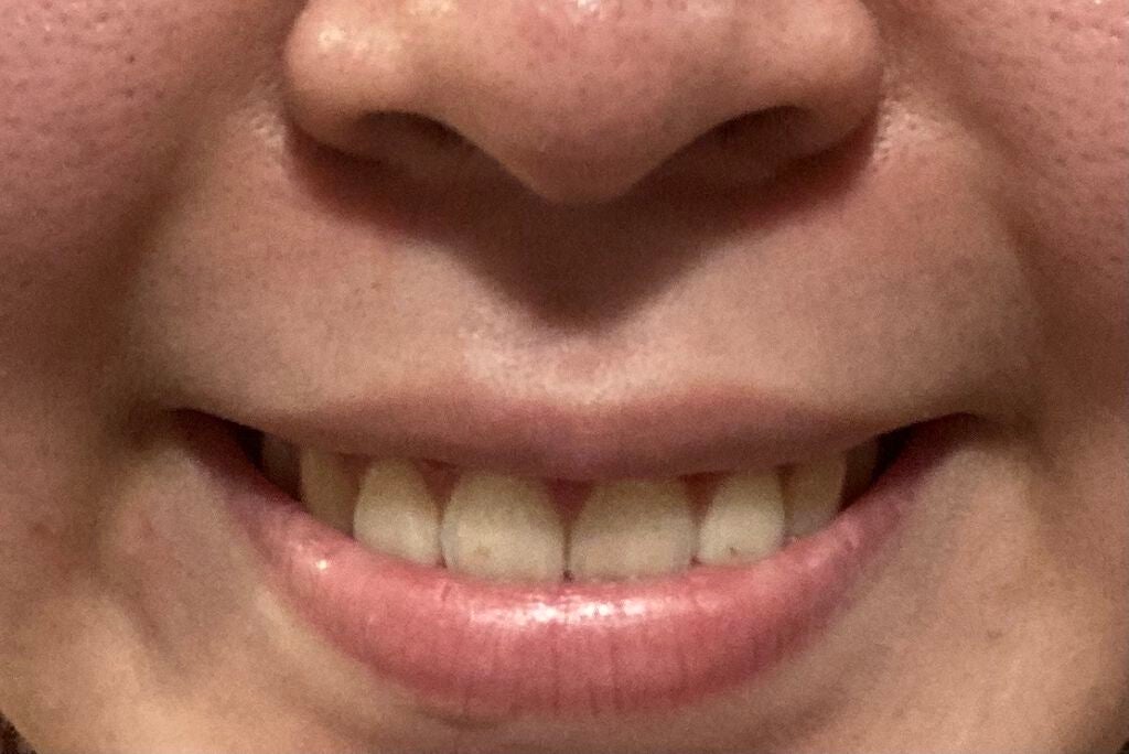 清潔感Quest on LIPS 「鼻先から口元にかけてかなり不恰好なんですけど、何が一目で見て目..」(2枚目)