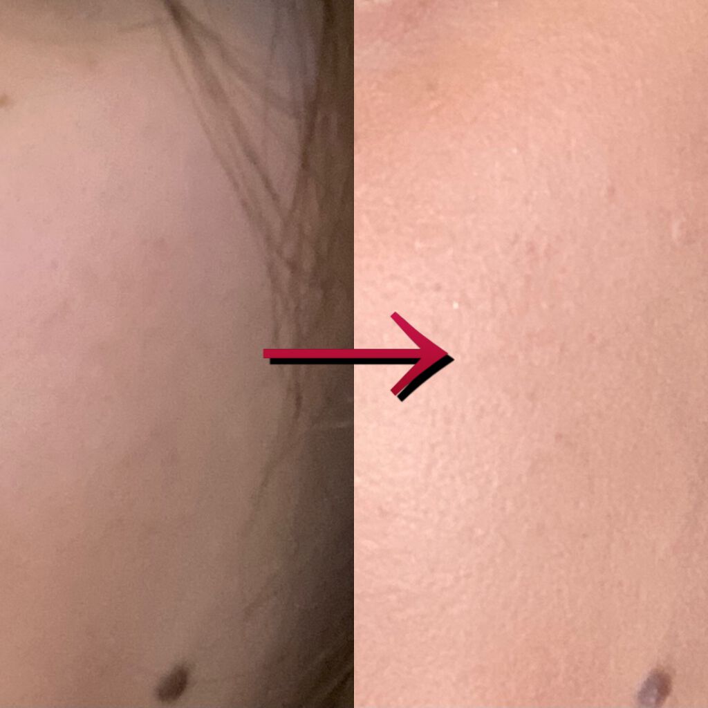 V3 エキサイティングファンデーション/SPICARE/クッションファンデーションを使ったクチコミ(3枚目)