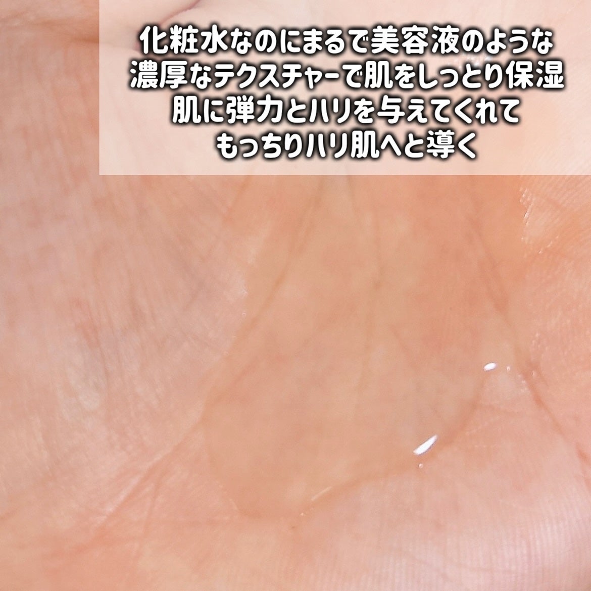 オイデルミン エッセンスローション/SHISEIDO/化粧水を使ったクチコミ(4枚目)