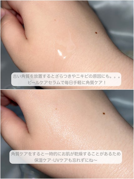 エファクラ ピールケア セラム/ラ ロッシュ ポゼ/美容液を使ったクチコミ(3枚目)