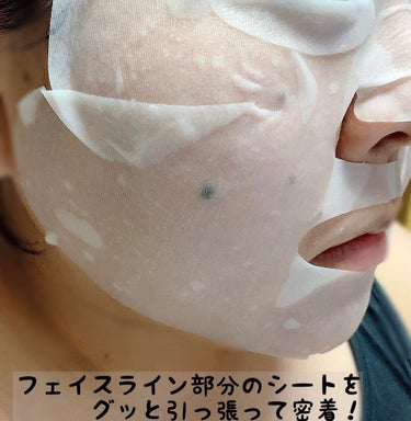 Bright ホワイト メラノリーチ エッセンス マスク/Ｎ organic/シートマスク・パックを使ったクチコミ（3枚目）