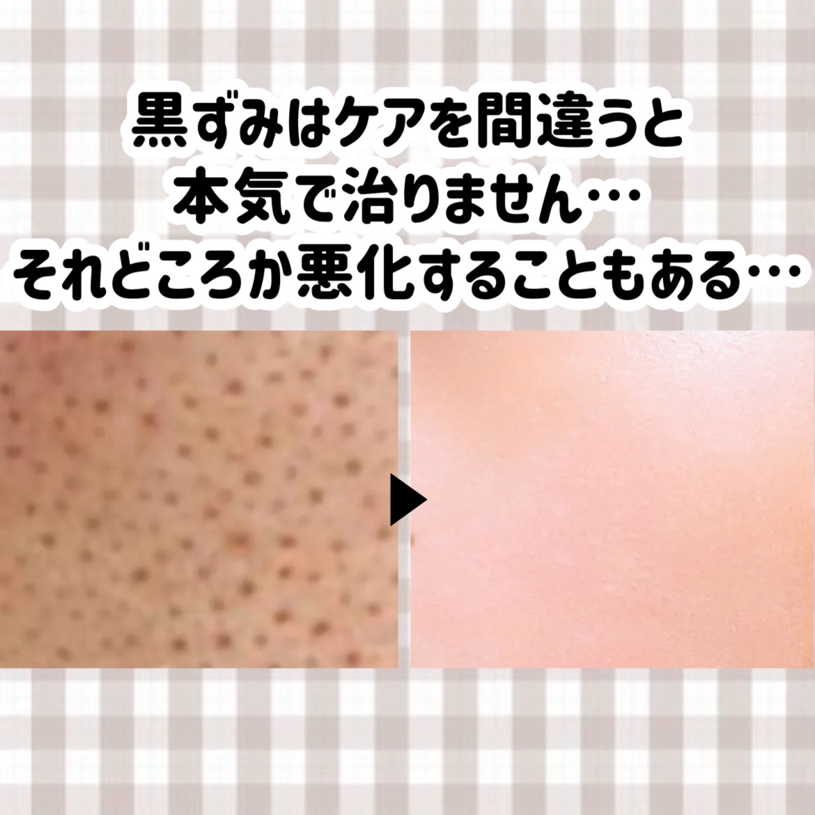 スウィートアーモンドオイル/無印良品/ボディオイルを使ったクチコミ（2枚目）