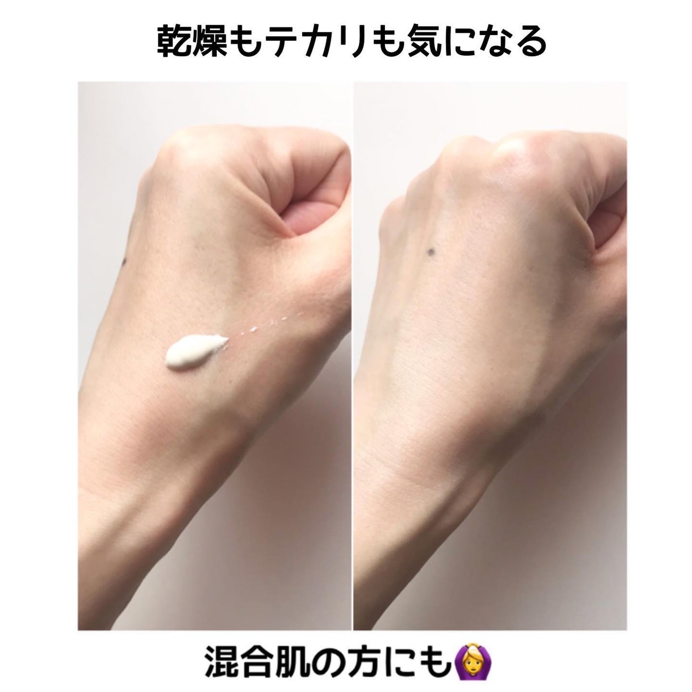 エファクラ ピールケア セラム/ラ ロッシュ ポゼ/美容液を使ったクチコミ(2枚目)