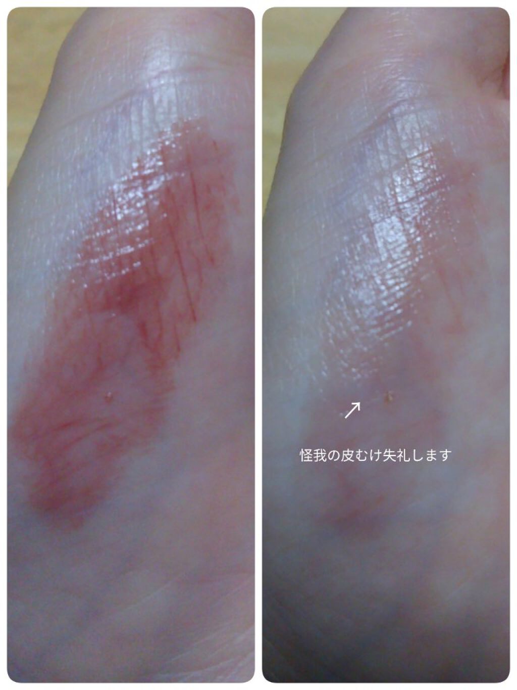 ケイト リップモンスター/KATE/口紅を使ったクチコミ（2枚目）