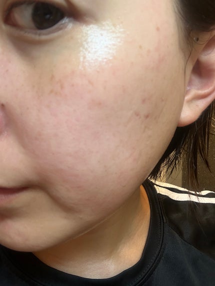 スペシャルパウダーソープCure/Cure/洗顔パウダーを使ったクチコミ(4枚目)