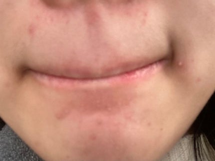 ヘルプミー! ダクトパッド/One-day's you/トナーパッドを使ったクチコミ(3枚目)