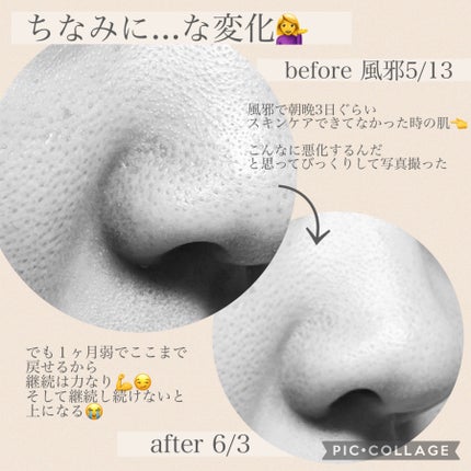 ケアセラ APフェイス&ボディ乳液/ケアセラ/ボディミルクを使ったクチコミ(6枚目)