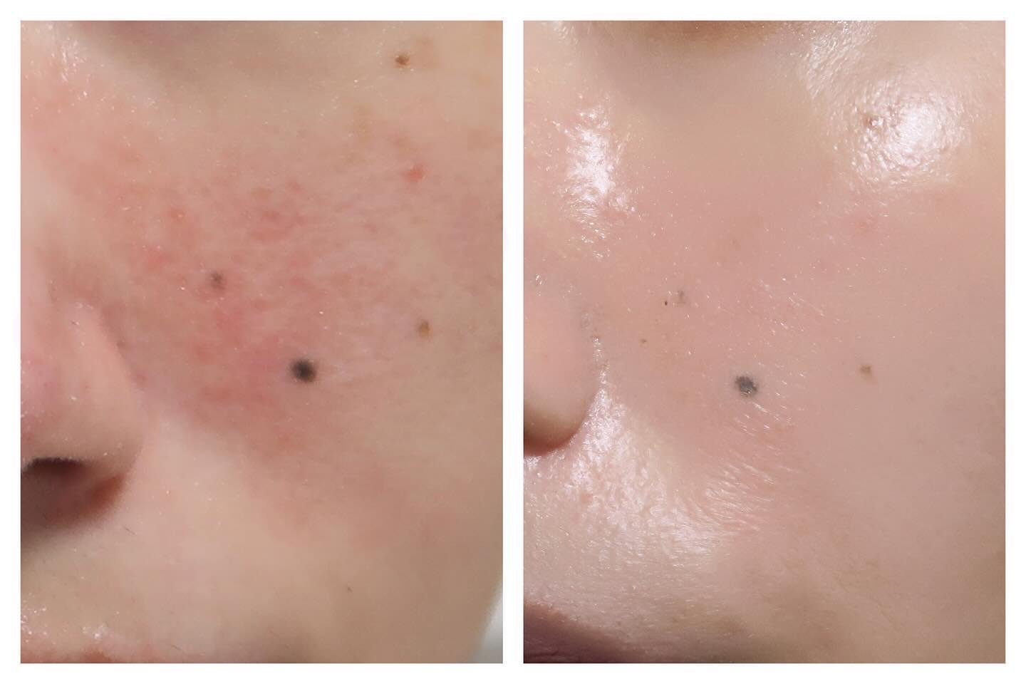 アートレス パーフェクト クッション #23 Natural Beige/heimish/クッションファンデーションを使ったクチコミ（3枚目）