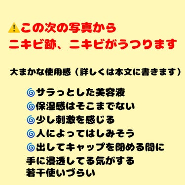 メラノCC 薬用しみ集中対策 プレミアム美容液のクチコミ「⚠️ニキビ跡、ニキビの写真に注意⚠️
苦手な人は見ないでください🙇‍♀️💦
📷肌の写真はどっち.....」（2枚目）