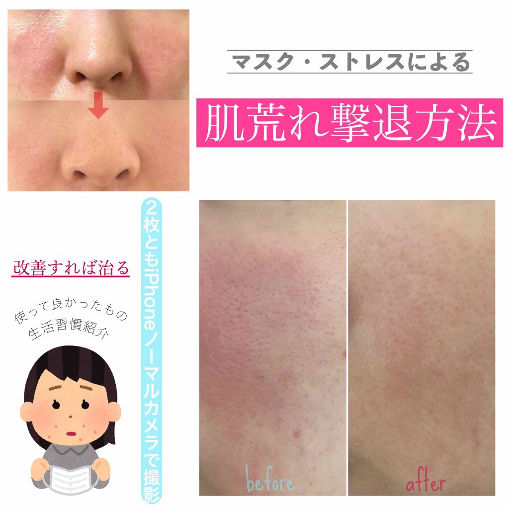 モイストバランス  ローション/ACSEINE/化粧水を使ったクチコミ（1枚目）