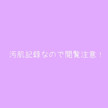 ドクダミ77% スージングトナー/Anua/化粧水を使ったクチコミ（2枚目）