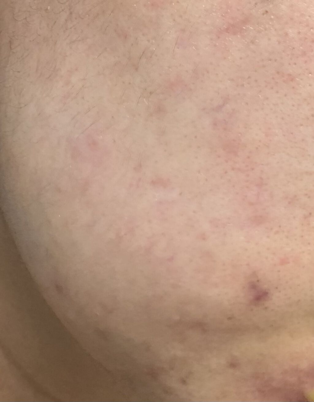 フェイシャリスト ファーメントパウダー/シーボン．/その他洗顔料を使ったクチコミ（3枚目）