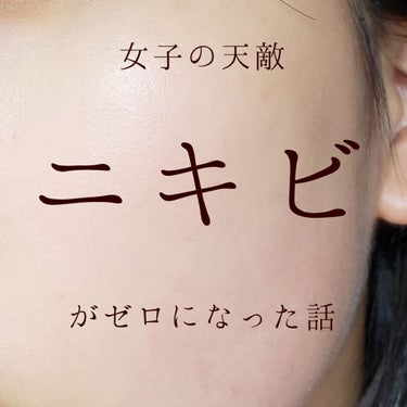 nene on LIPS 「こんにちは、neneです。今日は、私がニキビを撲滅したお話をし..」（1枚目）