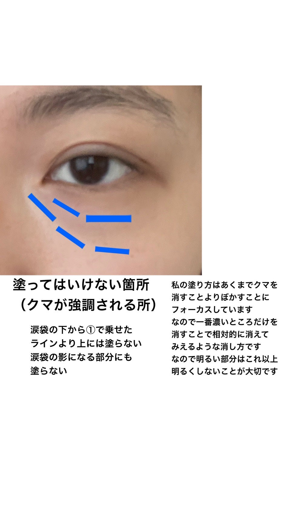 トーンパーフェクティング パレット/DECORTÉ/パレットコンシーラーを使ったクチコミ(6枚目)