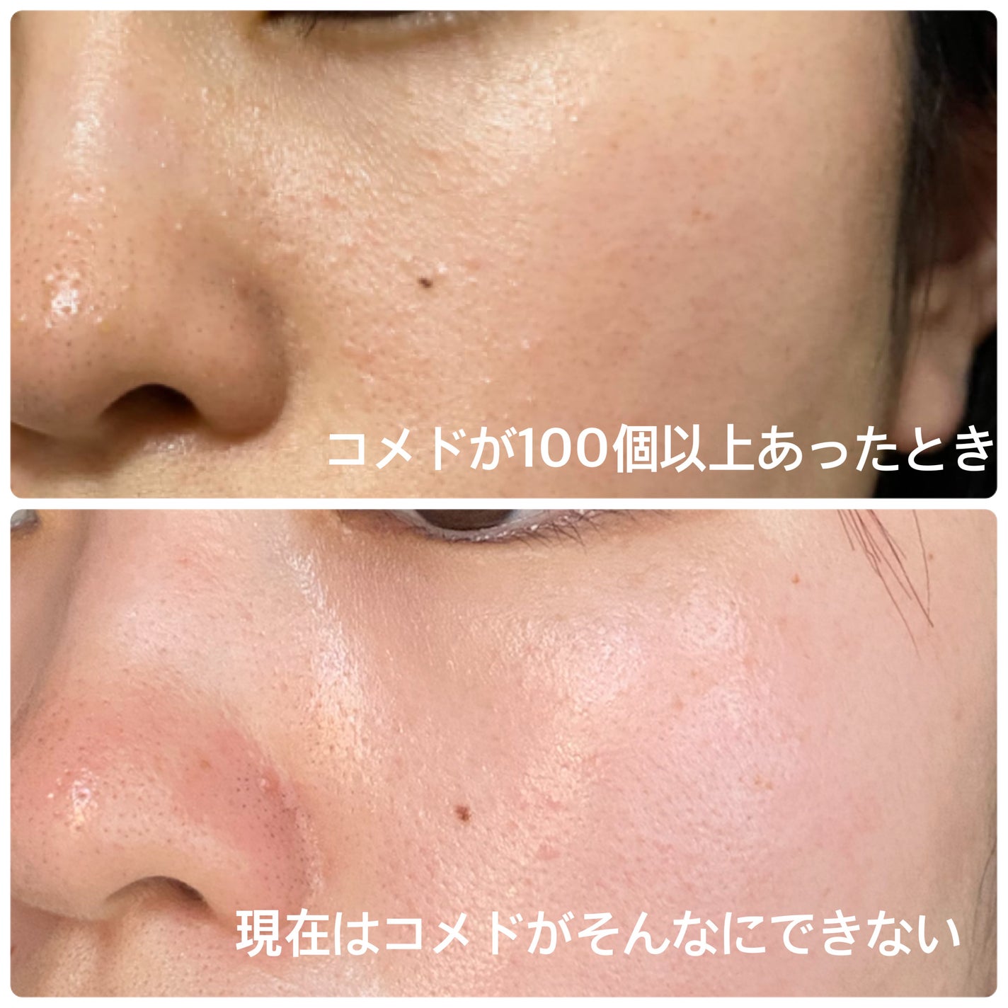 ミルキィ クレンズアップ/ACSEINE/ミルククレンジングを使ったクチコミ(4枚目)