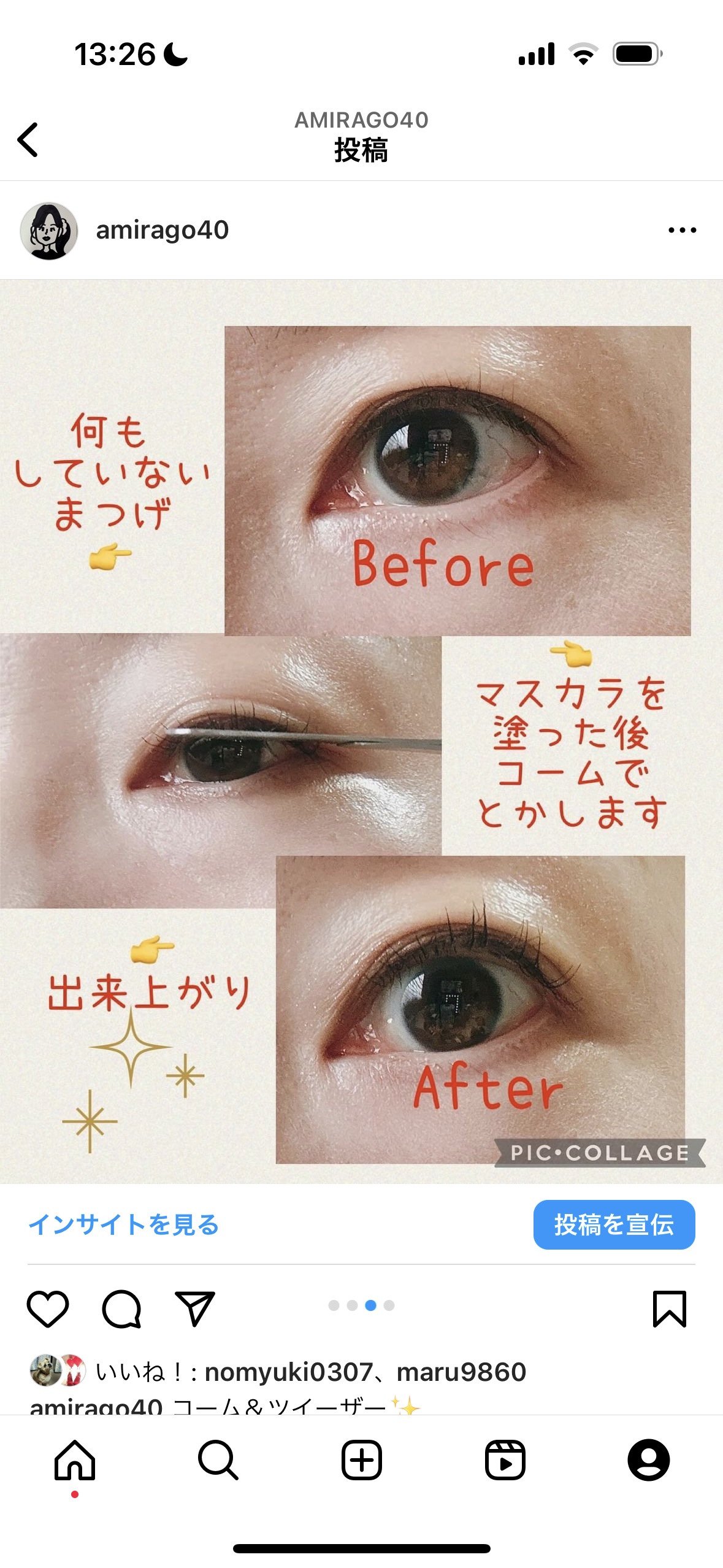 コーム&ツイーザー/ミッシュブルーミン/毛抜きを使ったクチコミ（3枚目）