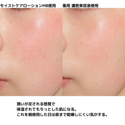 モイストケア ローション MB/d プログラム/化粧水を使ったクチコミ(10枚目)