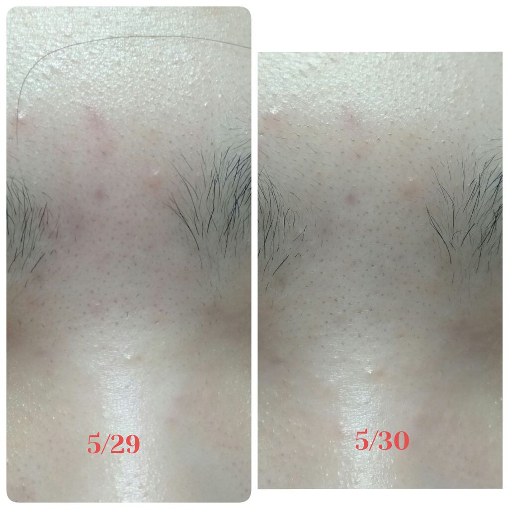 薬用しみ対策 美白化粧水/メラノCC/化粧水を使ったクチコミ(3枚目)