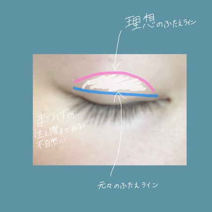 オリシキ アイリッドスキンフィルム		/D-UP/二重まぶた用アイテムを使ったクチコミ(3枚目)