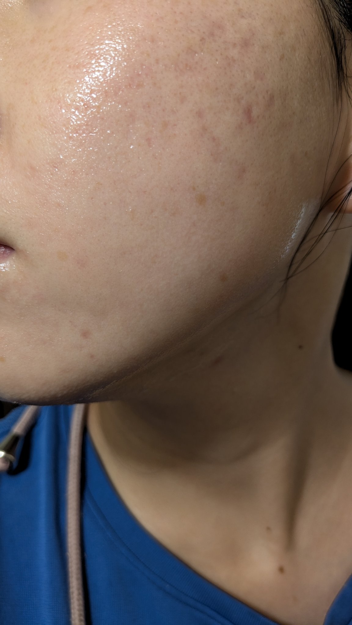 A2+NAG2ソリューション/The Ordinary/美容液を使ったクチコミ（2枚目）