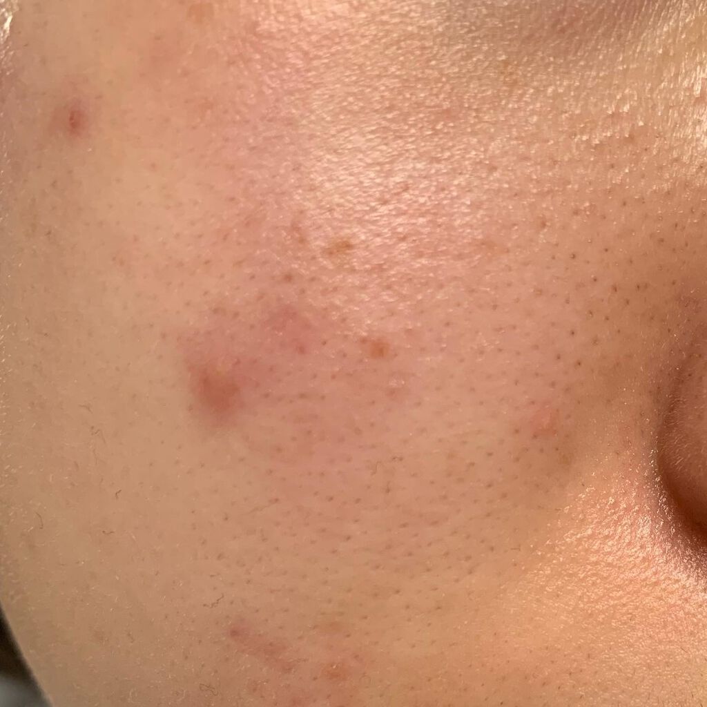 ブラックシュガー パーフェクト エッセンシャル スクラブ2X/SKINFOOD/洗い流すパック・マスクを使ったクチコミ(2枚目)