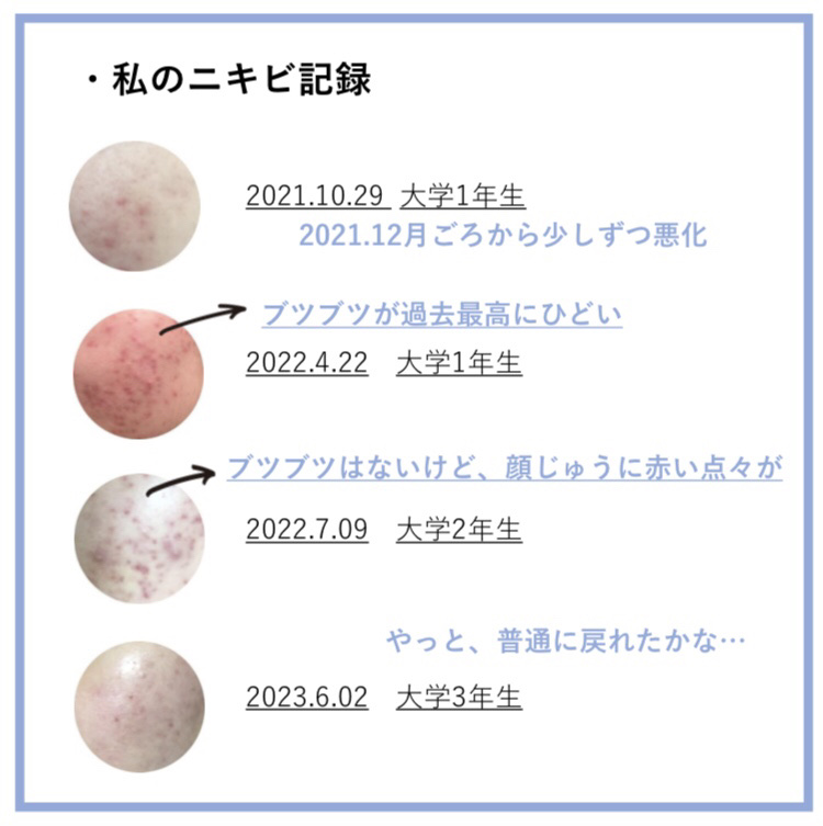 マイルドミルククレンジング/無印良品/ミルククレンジングを使ったクチコミ（3枚目）