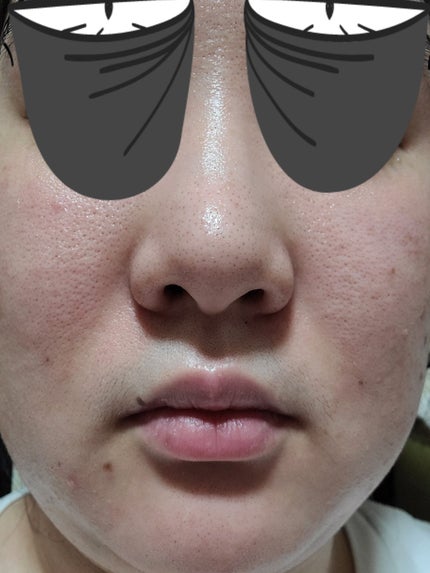 ハイドロクリーム SHQ-10/KISO/フェイスクリームを使ったクチコミ(3枚目)