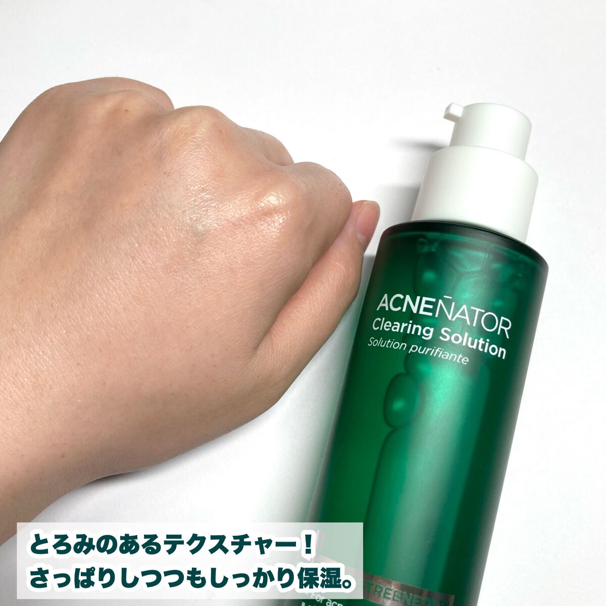 アクネネータークリアリングクレンジングフォーム/HOLIKA HOLIKA/化粧水を使ったクチコミ(7枚目)