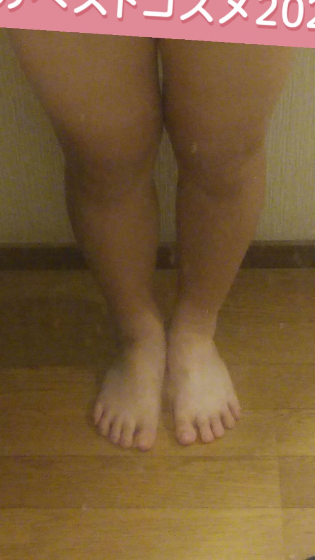 ハトムギ化粧水(ナチュリエ スキンコンディショナー R )/ナチュリエ/化粧水を使ったクチコミ（2枚目）