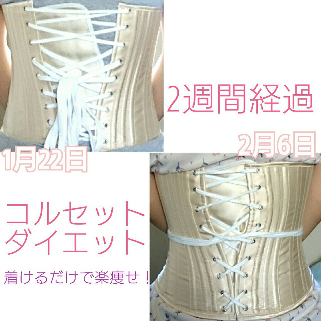 コルセット/ボディグッズを使ったクチコミ（1枚目）