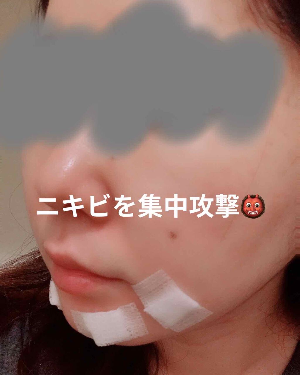 血の池軟膏(医薬品)/血の池地獄/その他を使ったクチコミ（3枚目）