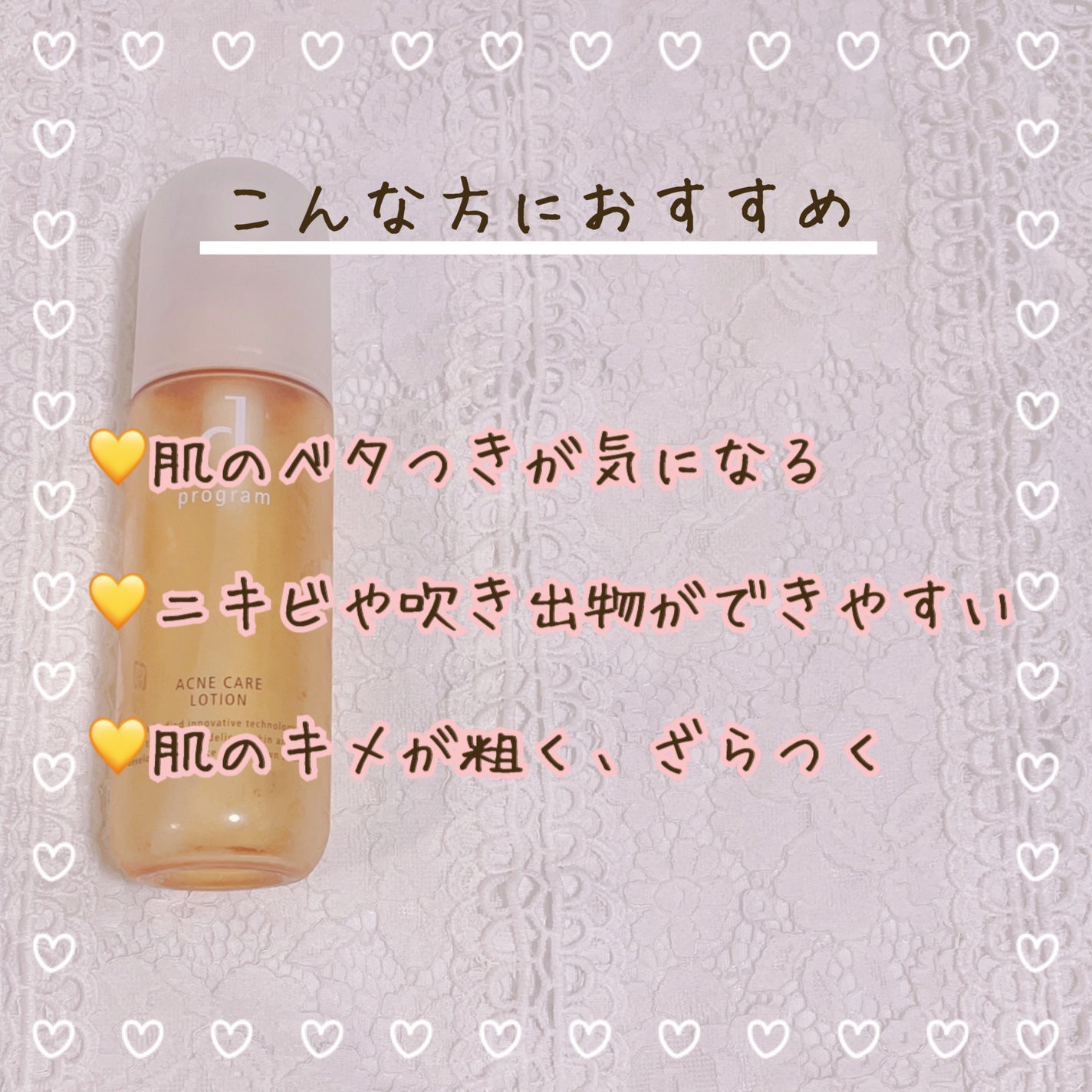 アクネケア ローション MB/d プログラム/化粧水を使ったクチコミ(4枚目)