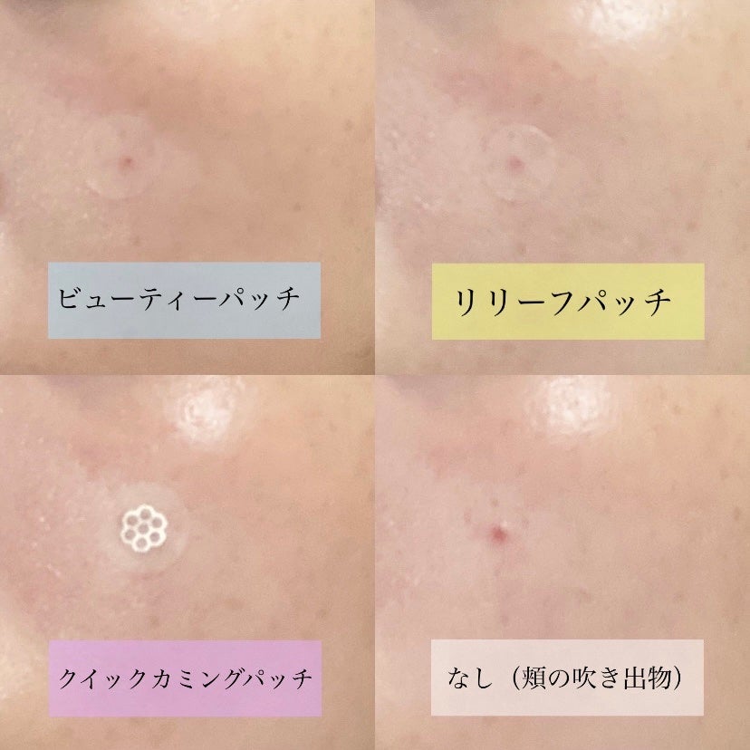 ビューティー スポットパッチ/イージーダムビューティー/にきびパッチを使ったクチコミ(6枚目)