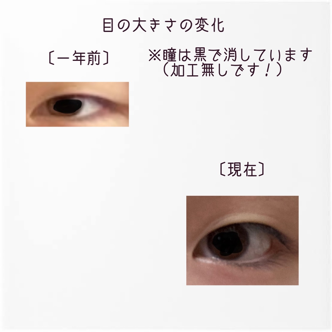 ナチュラルアイロールオンN 15ml【旧】/カントリー&ストリーム/アイケア・アイクリームを使ったクチコミ（2枚目）