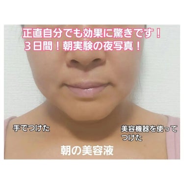 美肌カウンセラー💆綺麗のお助け相談所 on LIPS 「欲しいのは加工の要らないお肌とフェイスライン🧙★☆３枚目、本当..」（3枚目）