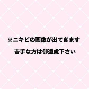 りょう on LIPS 「妊娠中のニキビケアについて🤰妊娠をキッカケにニキビが大量発生⚠..」（2枚目）