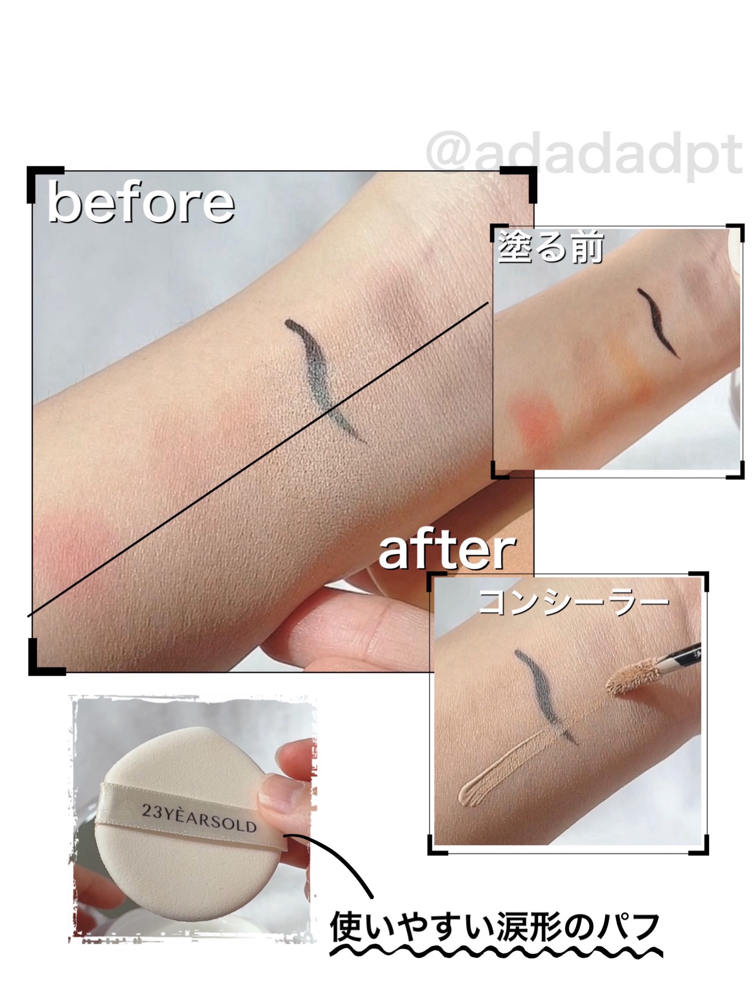 ダーマシンコンシーラー/23years old/リキッドコンシーラーを使ったクチコミ（2枚目）