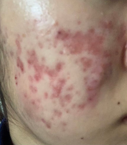 を使ったクチコミ(2枚目)