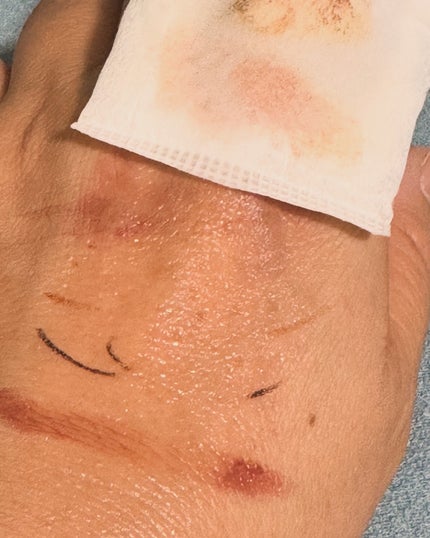 カナデル クレンジングウォーター/CANADEL/クレンジングウォーターを使ったクチコミ(6枚目)