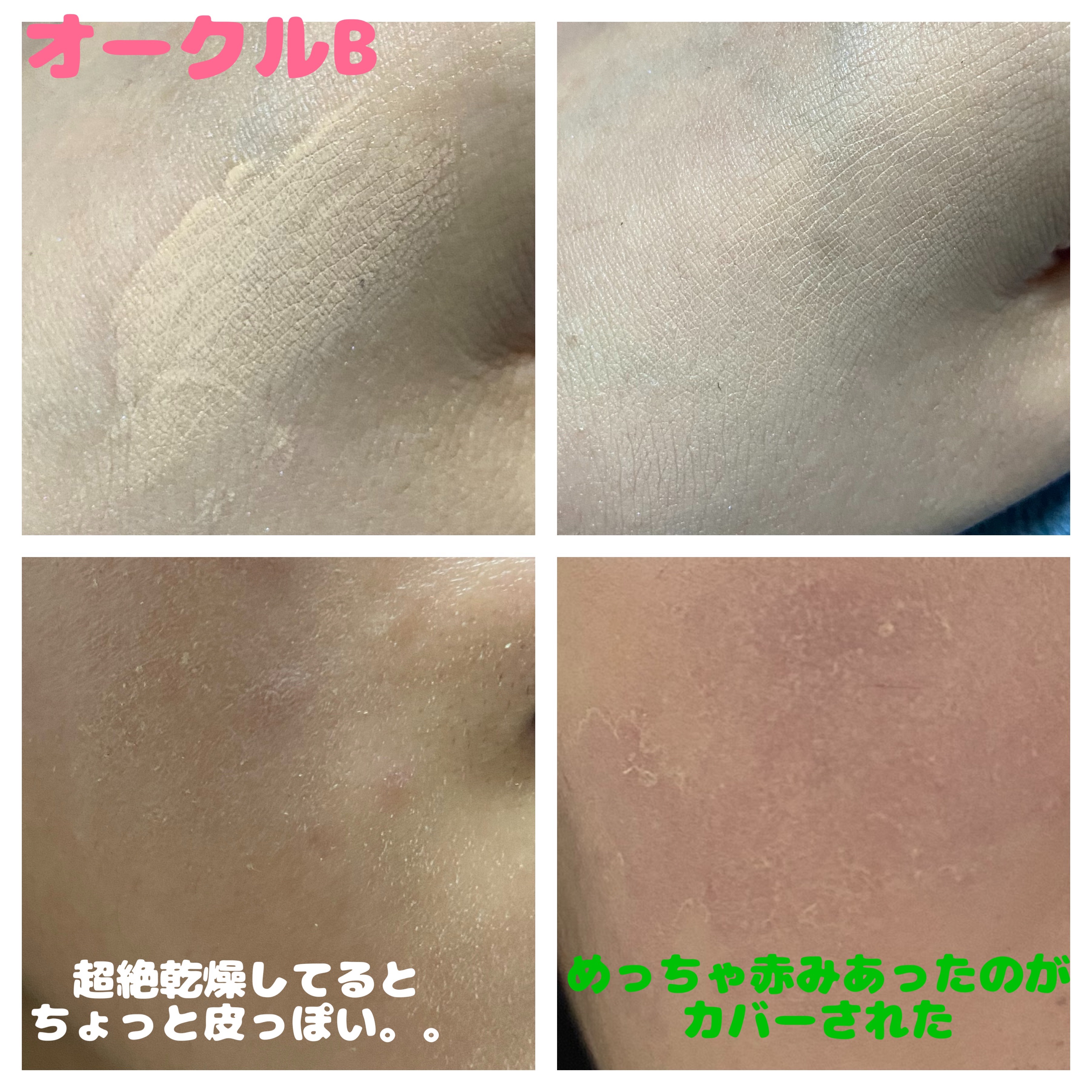 コンフォートスキン　ウェア/KANEBO/リキッドファンデーションを使ったクチコミ（2枚目）