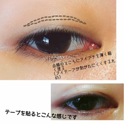 アイトーク/アイトーク/二重まぶた用アイテムを使ったクチコミ(3枚目)