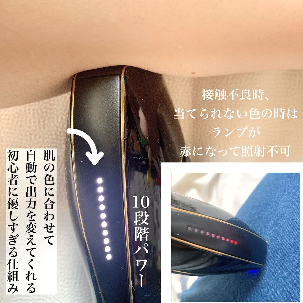 スムーズスキン pure fit ブラック/スムーズスキン/家庭用脱毛器を使ったクチコミ（2枚目）