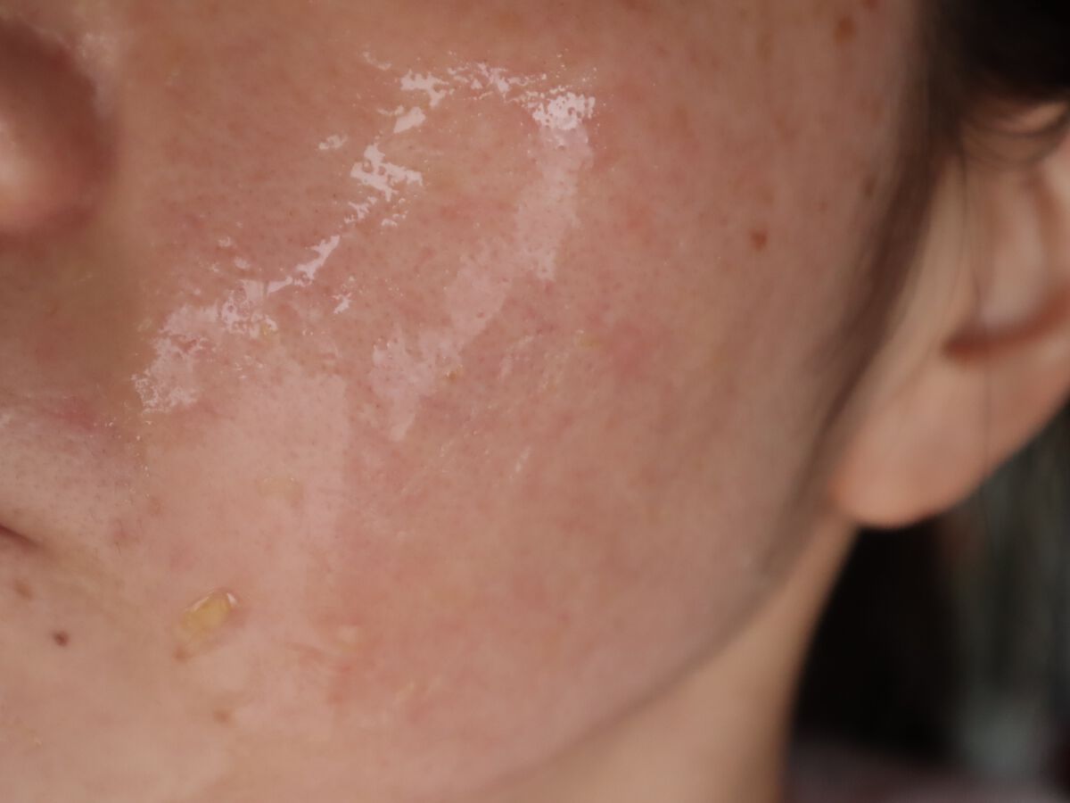 リアルカレンデュラピールオフパック/APRILSKIN/ピーリングを使ったクチコミ(4枚目)