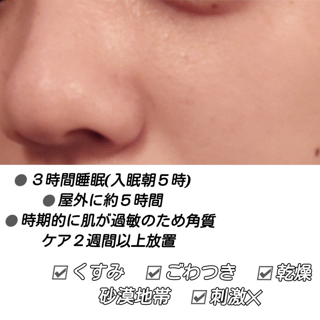 ルミエール ヴァイタルC/FEMMUE/ブースター・導入液を使ったクチコミ(5枚目)