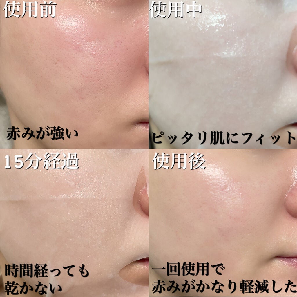 弱酸性pHシートマスク ドクダミフィット/Abib /シートマスク・パックを使ったクチコミ(3枚目)