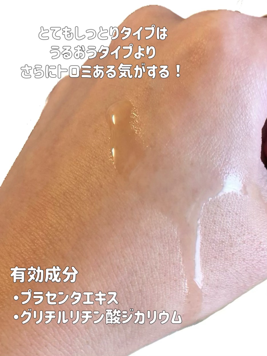 ネイチャーコンク 薬用 クリアローションとてもしっとり/ネイチャーコンク/拭き取り化粧水を使ったクチコミ（3枚目）