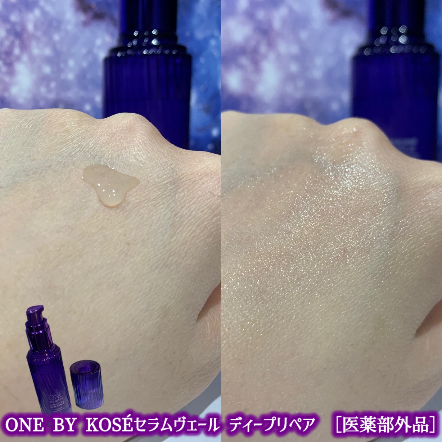 セラムヴェール ディープリペア/ONE BY KOSE/美容液を使ったクチコミ(4枚目)