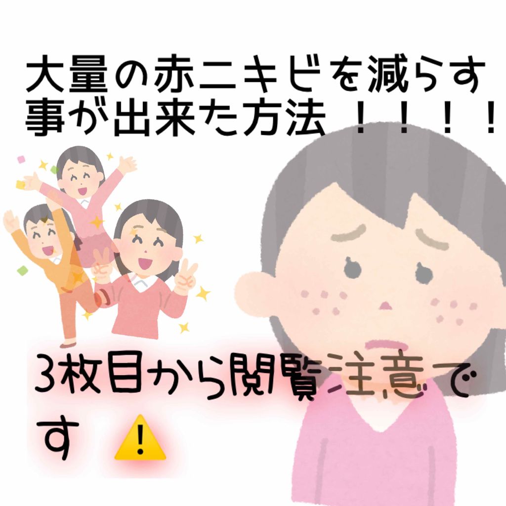 ロゼット洗顔パスタ アクネクリア/ロゼット/洗顔フォームを使ったクチコミ(1枚目)