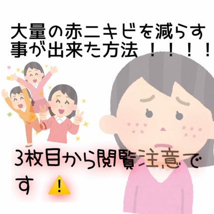 ロゼット洗顔パスタ アクネクリア/ロゼット/洗顔フォームを使ったクチコミ(1枚目)