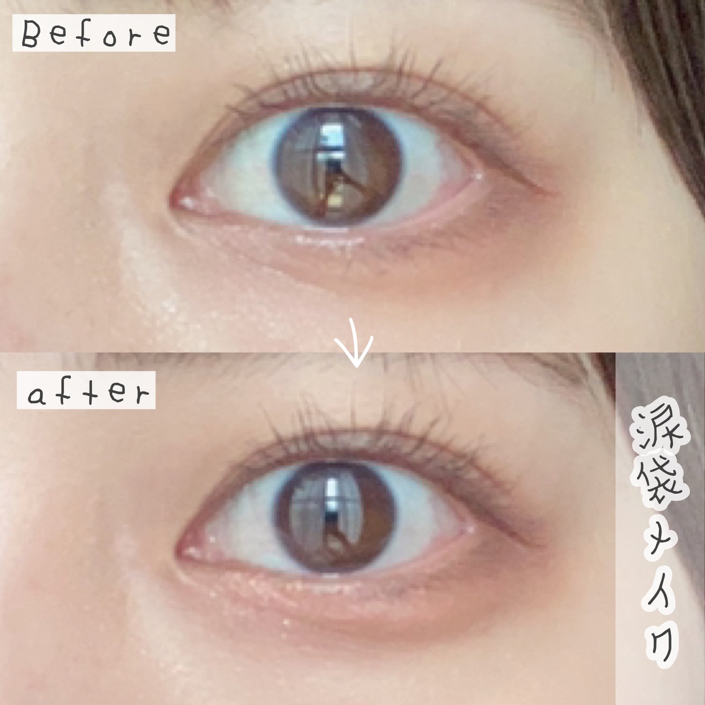 アイセラムコンシーラー/ティンカーウィンク/ペンシルコンシーラーを使ったクチコミ(1枚目)